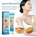 Crema para reducir bultos de grasa (lipomas)